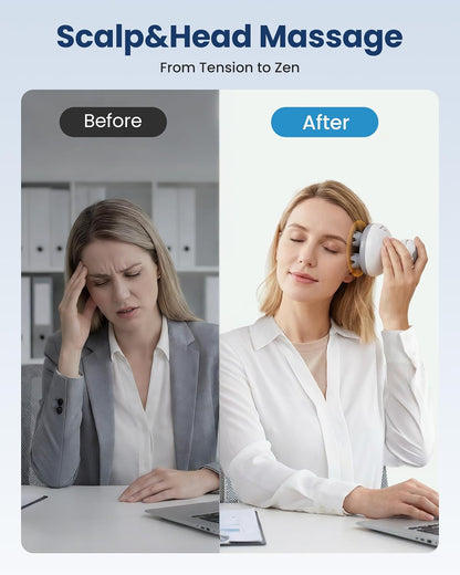 Rechargeable Electric Scalp Massager